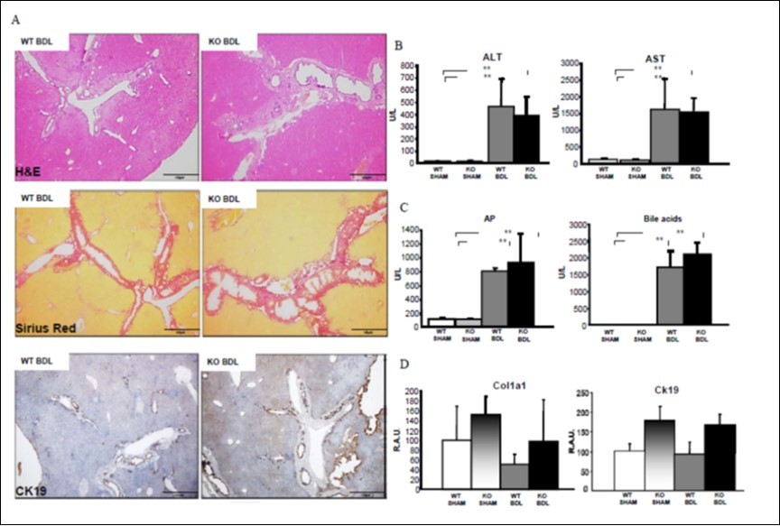 Figure 3. Pnpla3 deficiency does not affect liver injury, biliary fibrosis or damage in a BDL mouse model. A: H&E, Sirius red and CK19 staining did not show any differences between WT- and Pnpla3-KO BDL mice. B&C: ALT, AST, AP and bile acids levels increased in BDL-subjected mice irrespective of the genotype. D: Col1a1 and CK19 gene expression were unaffected by BDL between the genotypes (n=3 per group).