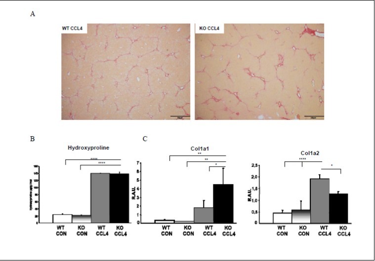 Figure 7. PNPLA3 does not mitigate nor worsen CCl4 induced hydroxyproline and collagen gene expression. Fig7A&B. Sirius Red staining and hydroxyproline measurement showed that WT and PnplaA3 KO mice had similar degrees of fibrosis upon CCl4 injection. Fig7C: Col1a1 expression increased more in Pnpla3KO upon CCl4, when Col1a2 expression was reduced compared to WT mice.