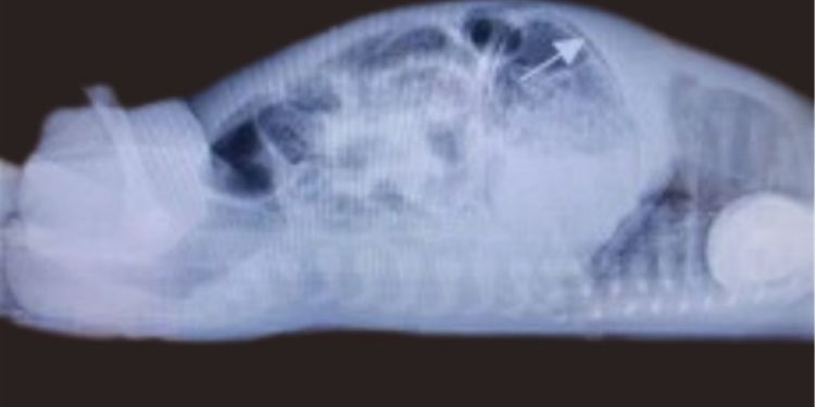 Cross table lateral radiograph showing gastric pneumatosis