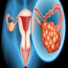 Journal of Embryology - Ovarian Hyperstimulation