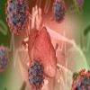 International Journal of Clinical Microbiology - pericardial fluid infection